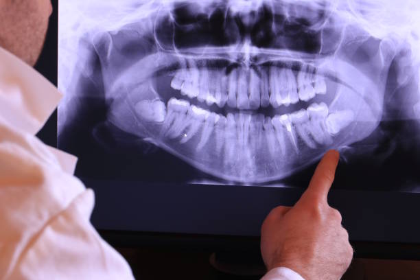 Best Pediatric Emergency Dentist in Olive Hill, KY